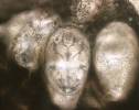 Sarcoptes scabiei - zákožka svrabová