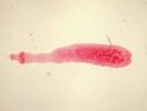 Echinococcus granulosus - měchožil zhoubný