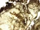 Sarcoptes scabiei - zákožka svrabová