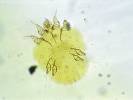 Sarcoptes scabiei - zákožka svrabová