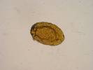 Ixodes ricinus - klíště obecné