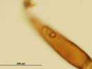 Ixodes ricinus - klíště obecné