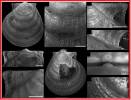 Hyalopecten kurilensis