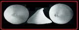Profundisepta circularis